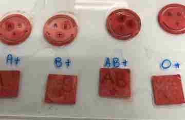  Apoio do Estado: curativo que identifica tipo sanguíneo em minutos passa por testes finais 